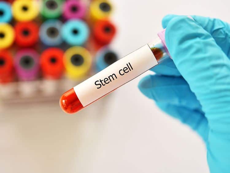 stem cell treatment los angeles stem cell treatment los angeles