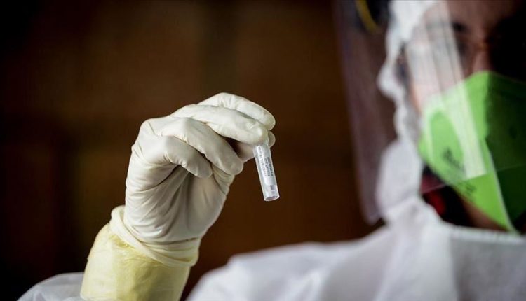 Covid 19 Deaths In The Uae Within 24 Hours Are Zero